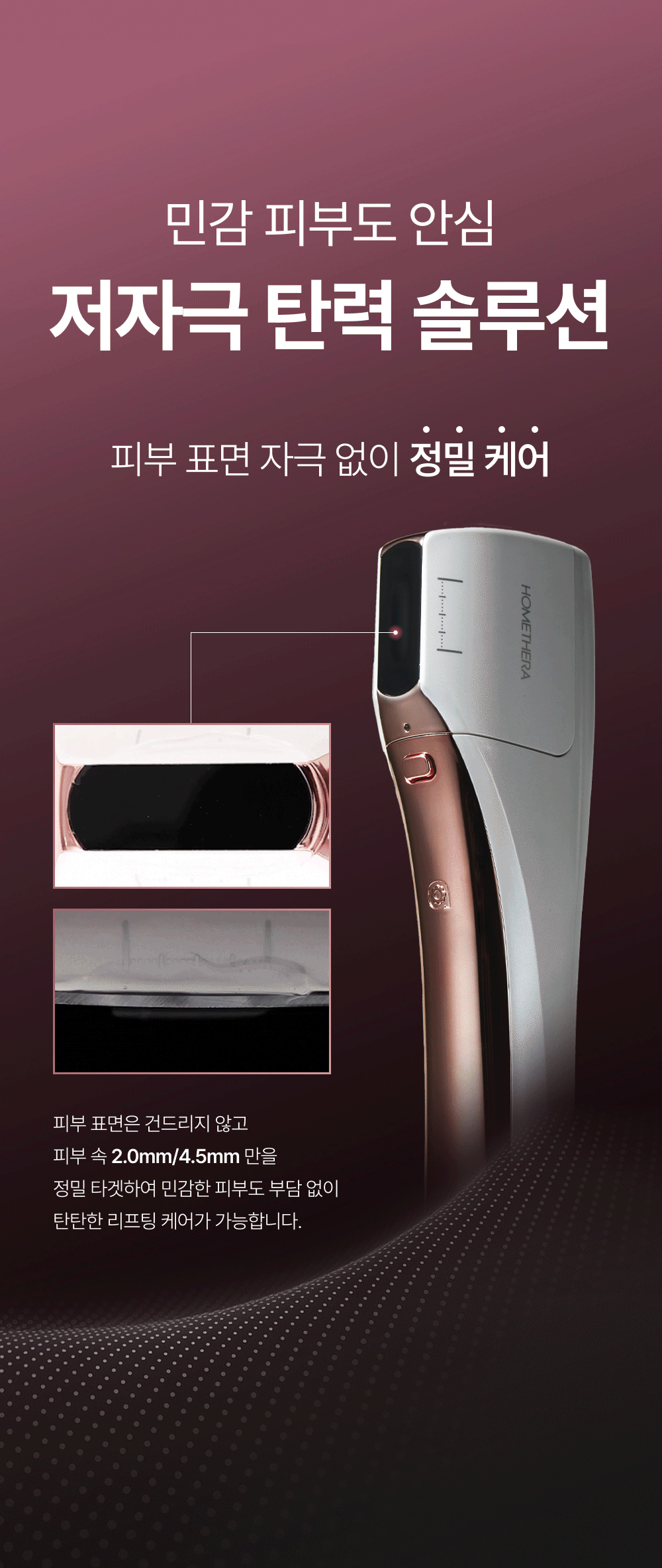 [아띠베뷰티] 홈쎄라 베이직케어 (5만샷 100만도트) (48개월) (2026) 상세 이미지 12